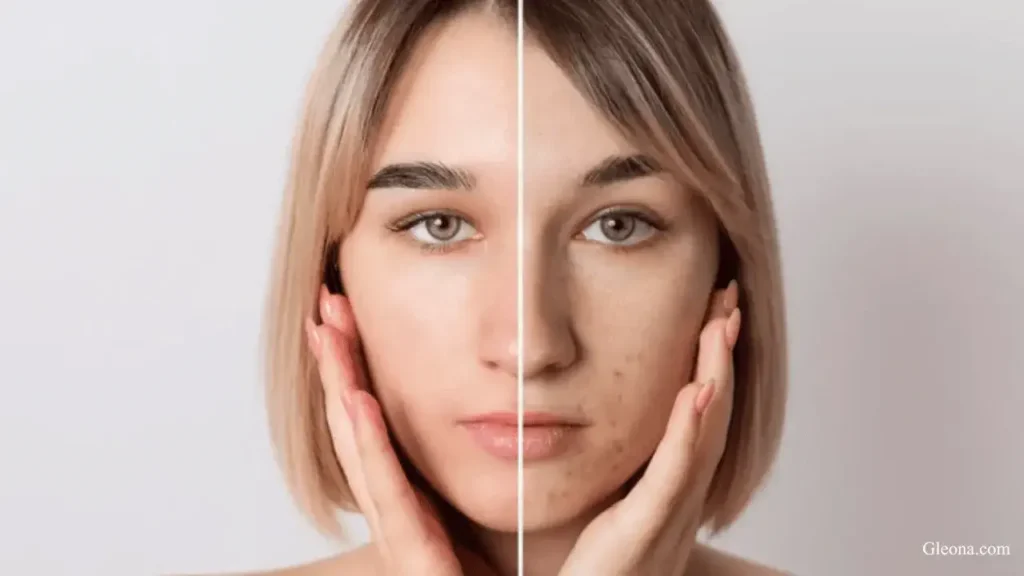 Fights Signs of Aging