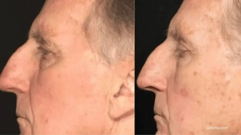 Genetics and Aging