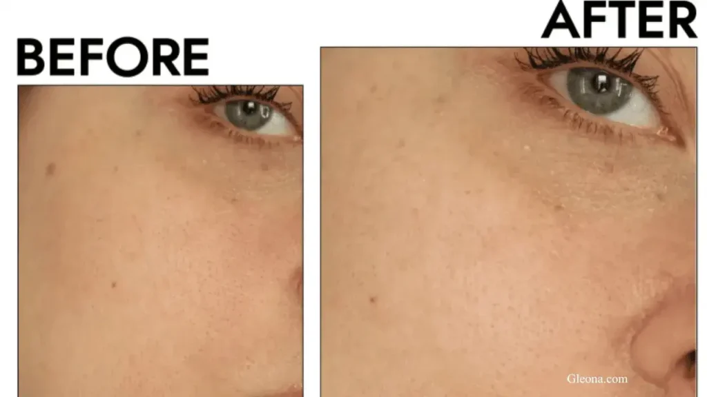 Minimizes Pores and Refines Texture