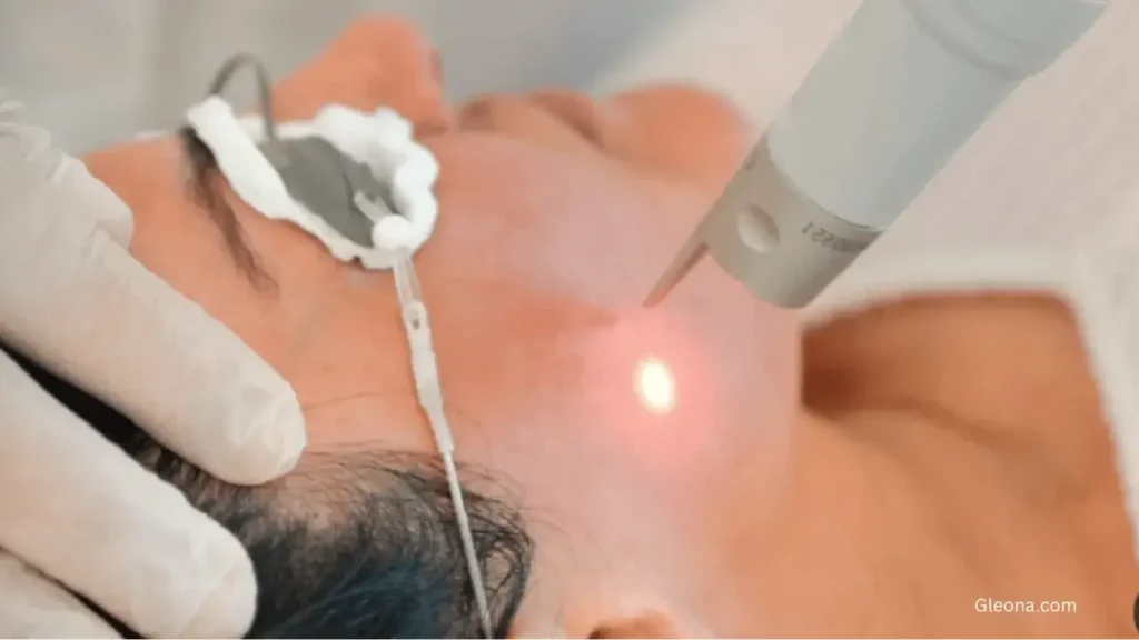 Professional Treatments (Dermatologist-Recommended)
