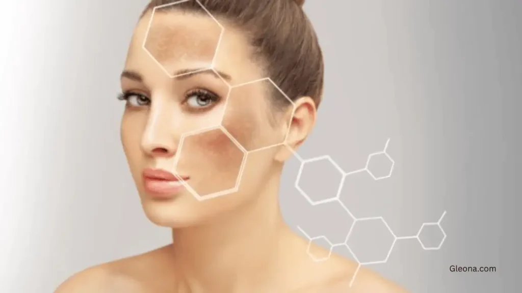 What is Hyperpigmentation