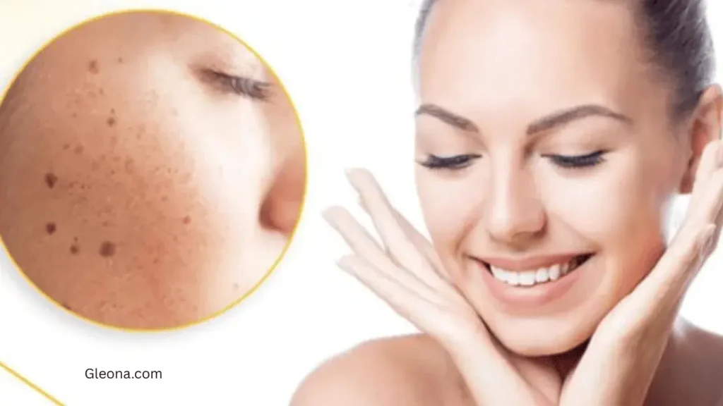 Lifestyle Changes That Help Reduce Hyperpigmentation Naturally
