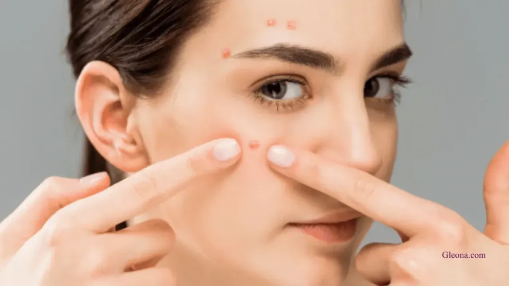Common Mistakes to Avoid When Treating Acne Spots