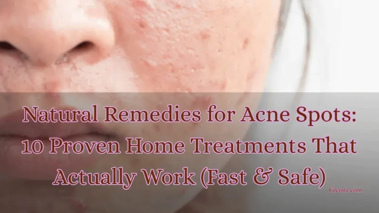 Natural Remedies for Acne Spots 10 Proven Home Treatments That Actually Work (Fast & Safe) Featured Image