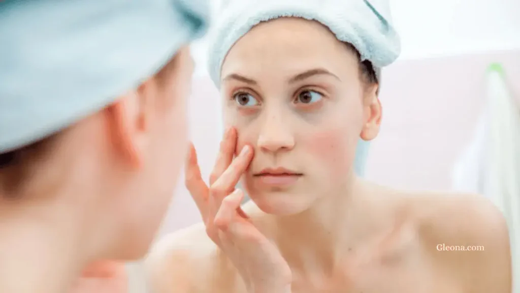 Step-by-Step Rosacea Skincare Routine (Tutorial)